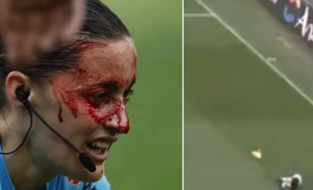Σκληρές εικόνες:  Βρέθηκε το βίντεο με το ατύχημα της βοηθού με την τηλεοπτική κάμερα (vid) | sports365.gr